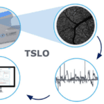 Diagram of how TSLO will work.