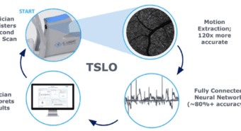 Diagram of how TSLO will work.
