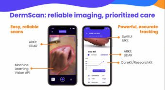 DermScan: reliable imaging, prioritized care